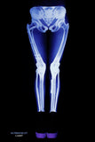 X-RAY SKELETON LEGGINGS